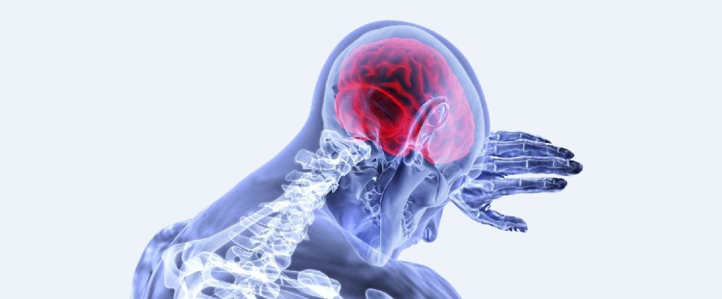 Latigazo Cervical compañia