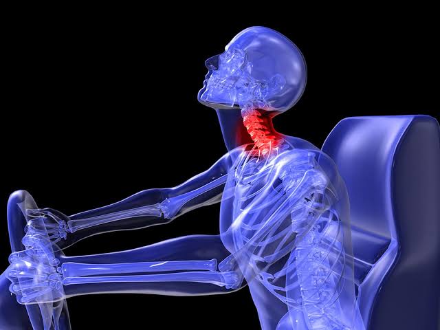 Latigazo Cervical